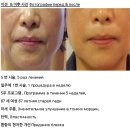 이연화피부관리실 | [공지]딱 15분 만에 피부재생의 원리(라피톡스)에 대해서 이해하는 방법