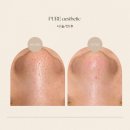 퓨어에스테틱 이미지