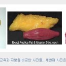 명문의료기 이미지