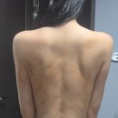 서울영림초등학교 | 영등포 경락 에이치테라피에서 괄사 등관리 후기