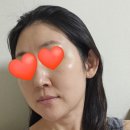 [듀얼 티타늄 3회차] 유지기간이 탁월한 티타늄리프팅 가격과 효과 후기, 삼성동 리프팅 패키지