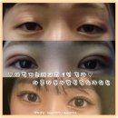 쌍수후기 많은 아름다운사람 성형외과의원 찾아오는길~*