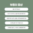 코끼리한의원 티스토리