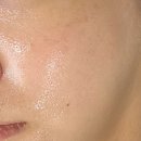 전포2치안센터 | 부산 서면 전포 블랙헤드,모공 전문 에스테틱 피부피티센터에서 세멘시트 관리 받은 후기