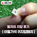 이혈 테라피 | 이혈기석 귀지압패치 후기, 이혈테라피로 스트레스 완화하기