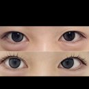압구정-109 | 압구정 속눈썹 윤이뷰티스튜디오 (전후사진有)