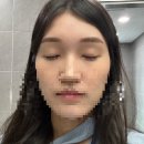 [여의도] 속눈썹연장 - 미인케어 / 무쌍 속눈썹 스타일 추천까지