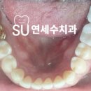 세라믹치과기공소 이미지