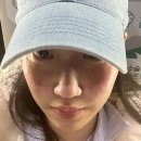 그린셀 | 인천 구월동 루비레이저 기미 주근깨 제거 잘하는 곳(내돈내산)