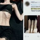 주)뼈세상 이미지