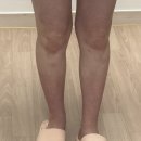 원더여성의원 | 침착 • 건조함 증상, 인천 가족보건의원 저렴하게 백일해 및 독감 예방접종, 원더맘스 산모교실 참석후기