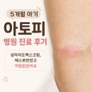 아토피하우스 | 5개월 아기 아토피 병원 진료 후기｜삼아리도멕스크림, 에스로반연고 처방받았어요