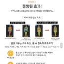 청담테라피 이미지