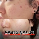 삼가프라자 | [노원] 노원피부과에서 리쥬란 대신 필로드 2cc 스킨부스터 받고 온 솔직 후기