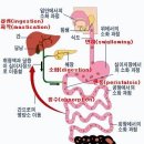 위염(Gastritis) 이미지