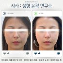 미소야 명일점 | 명일동 피부관리 샤사 명일고덕역점 위치.가격.시간.후기