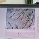 염색앤두피 - 천안시 서북구 | 인천두피관리 미추홀구 이어테라피 인천염색앤두피인하대점 후기