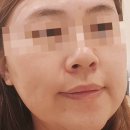 엘바피부샵 이미지