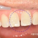 서울더믿음치과 이미지