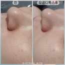 제석초등학교 | 봉선동 피부관리 올가드림뷰티 후기 광주 웨딩관리 모공디톡스