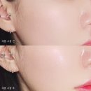 베리케어 이미지