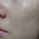 자향농장 | 임산부도 사용가능한, 겉은 산뜻 속은 촉촉 휴랑 쉬자 에센스
