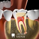 그리치과기공소 이미지
