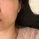신도림 예민피부 관리 잘하는 곳 스킨바이블 신도림점...예민피부도 안심하고 효과있게 관리한 후기