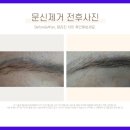 착한피부과 이미지