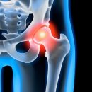 코끼리마취통증의학과의원 이미지