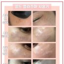 콜드플라즈마