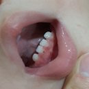 열상목장 | [12개월] 돌아기 발달 : 몸무게, 신발 사이즈, 이유식, 수유량, 수면시간, 낮잠, 말하기, 언어이해...