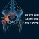 관골 | 생리통, 붓기, 허리 뻐근함까지 서면 골반순환관리로 해결