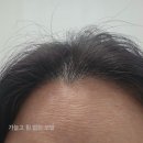 SNS 헤어