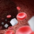 탑석장편한내과의원 | 고산동내과 당뇨병으로 인한 말초혈관질환은?