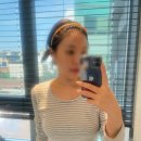 윤약국 | [내돈내산]눈밑지+얼굴 지방이식 후기 / 수술당일~3일 차(붓기, 여우눈, 일상생활)