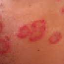 예안피부과의원 이미지