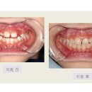 연세아이나라치과의원 네이버블로그