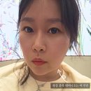 수피부과의원 | 울산 경주 온다리프팅, 남구 달동 피부과 의원 추천 후기