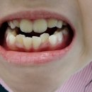 연세수치과교정과치과의원 네이버블로그