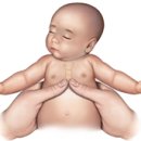 생명을 살리는 심폐소생술(CPR) 이미지