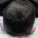 일러스라인 | [리얼후기] 휑했던 정수리의 기적, 학여울 구룡 대청 근처에서 찾은 인생 디자인!