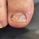 다시온 리케어 이미지