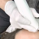 울산해리스뷰티 무거동 피부관리 플라즈마 후기