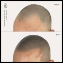 탈모왕 본점 이미지