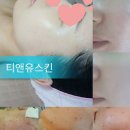 티앤유스킨