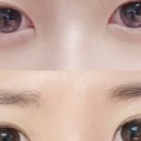 뷰티 썸 스킨 이미지