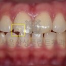 서울산성플란트치과의원 이미지