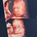 주수기록 : 22w~27w 태동 / 임당검사 / 중기증상 / 임신중기영양제 / 중기일상