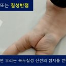 북두칠성반점 이미지